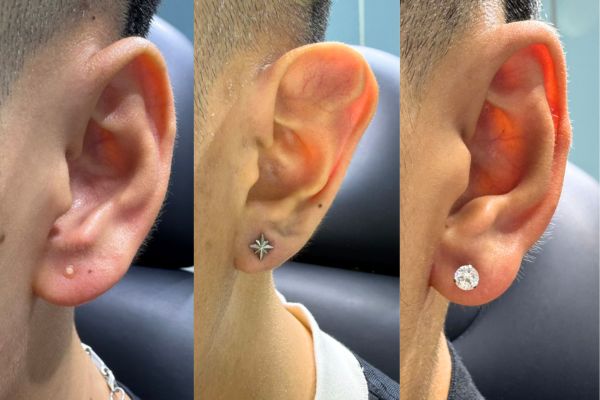 Xỏ khuyên tai bao lâu thì lành còn phụ thuộc vào chất liệu khuyên bạn đang đeo