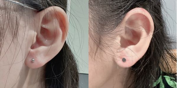 Hình ảnh xỏ khuyên tai em bé 2/2023 - Shop TinyBox 