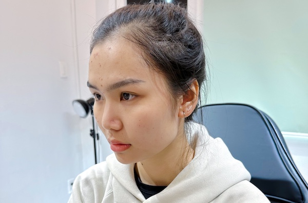 hình ảnh xỏ khuyên môi - hình ảnh xỏ khuyên mũi
