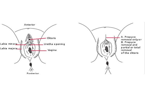 Xỏ khuyên vùng kín nữ ở đâu uy tín TPHCM?