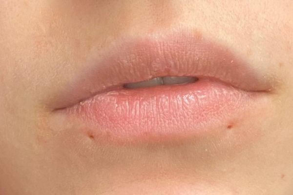 Xỏ lại môi có đau không? Khi nào có thể xỏ lại khuyên môi?