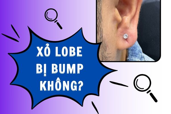 Xỏ lobe bị bump không?