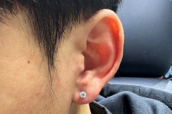 Xỏ lobe bị bump không?