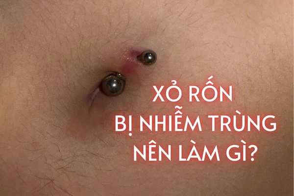 Xỏ rốn bị nhiễm trùng nên làm gì?