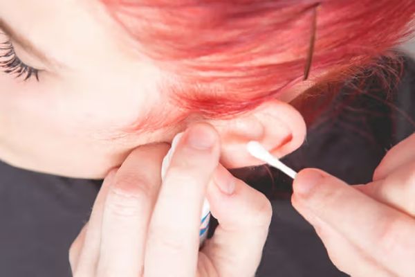 Xỏ rook bao lâu lành? 