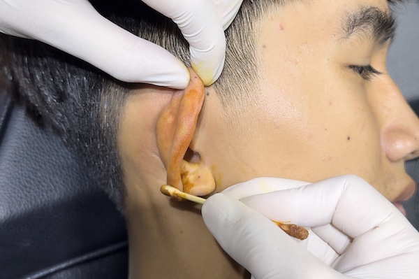 Xỏ Rook bao nhiêu tiền?