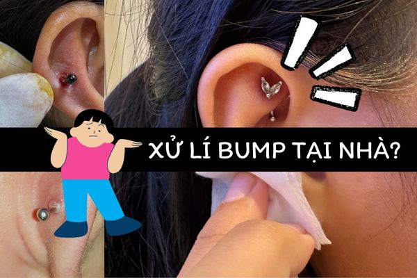 Xử lí lỗ xỏ bị bump tại nhà chi tiết từ A-Z hiệu quả