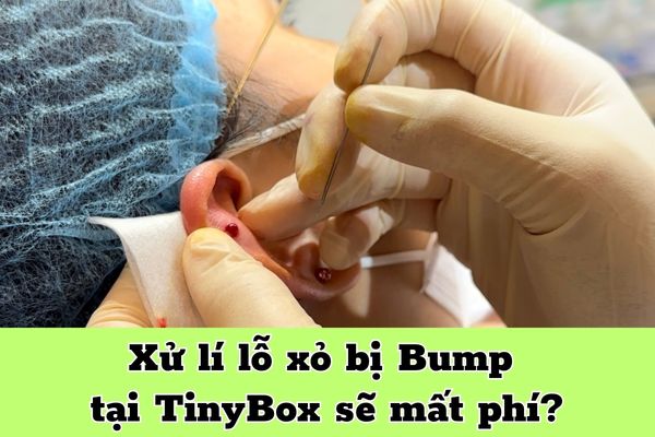 xử lí lỗ xỏ bị bump