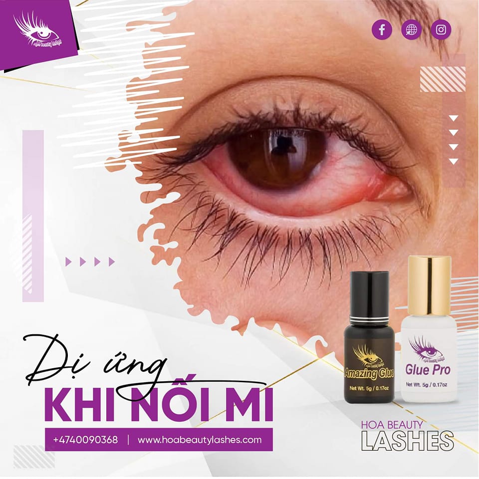 Nguyên nhân gây ra dị ứng từ keo nối mi