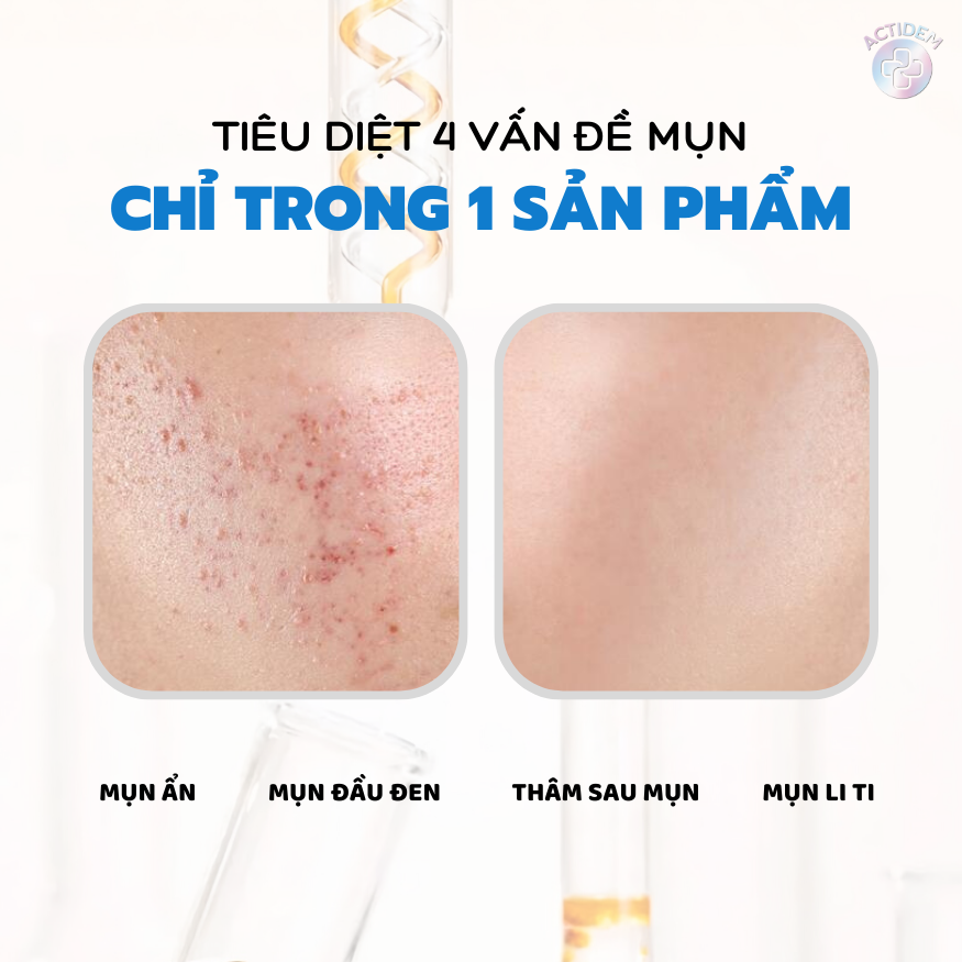 Công dụng của Gel giảm mụn