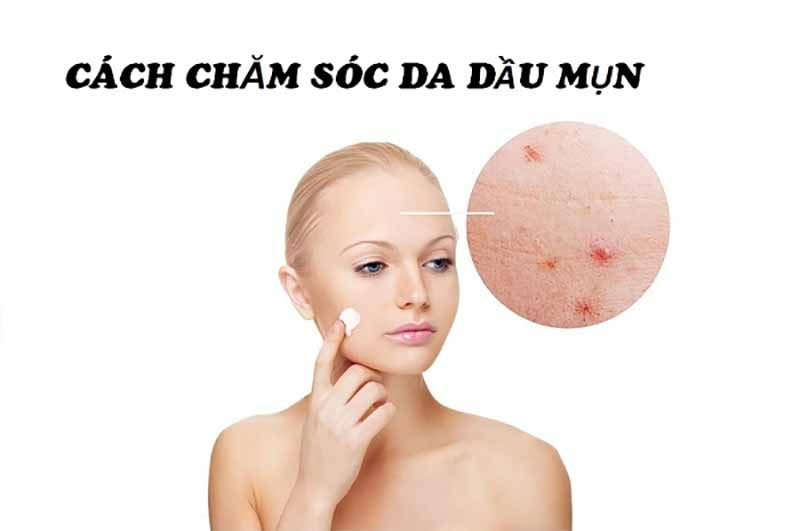 Bộ sản phẩm chăm sóc da dầu mụn