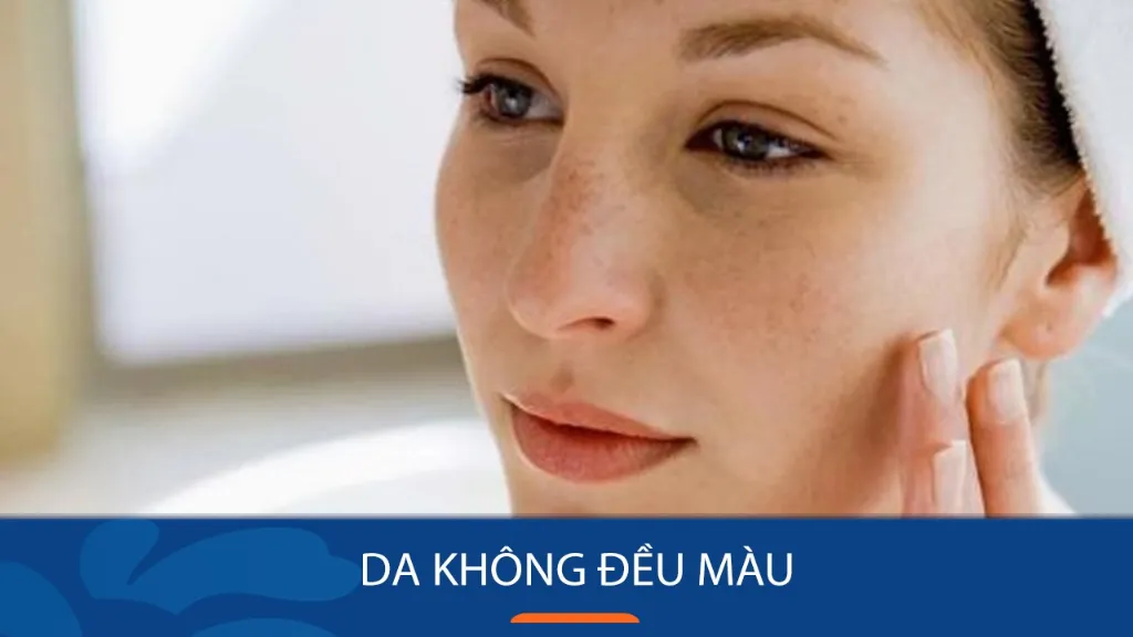 Da không đều màu