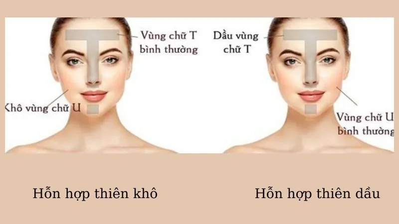 Phân biệt da hỗn hợp thiên dầu và thiên khô