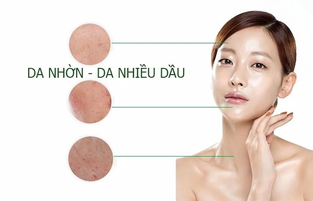 Giới thiệu chung về làn da dầu mụn