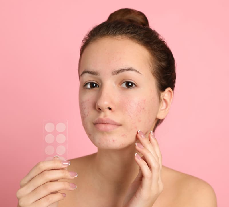 Cách loại bỏ mụn ẩn