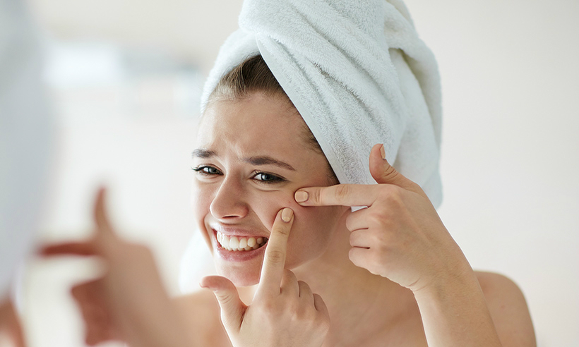 Cách nặn mụn ẩn đúng cách và giảm thương tích