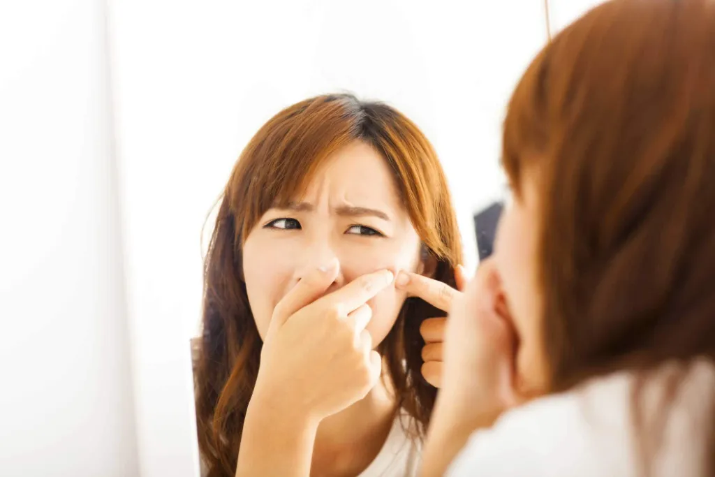 Nguyên Nhân Dẫn Đến Mụn Đầu Đen