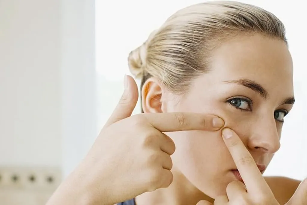 Không nặn mụn ẩn khi chăm sóc da