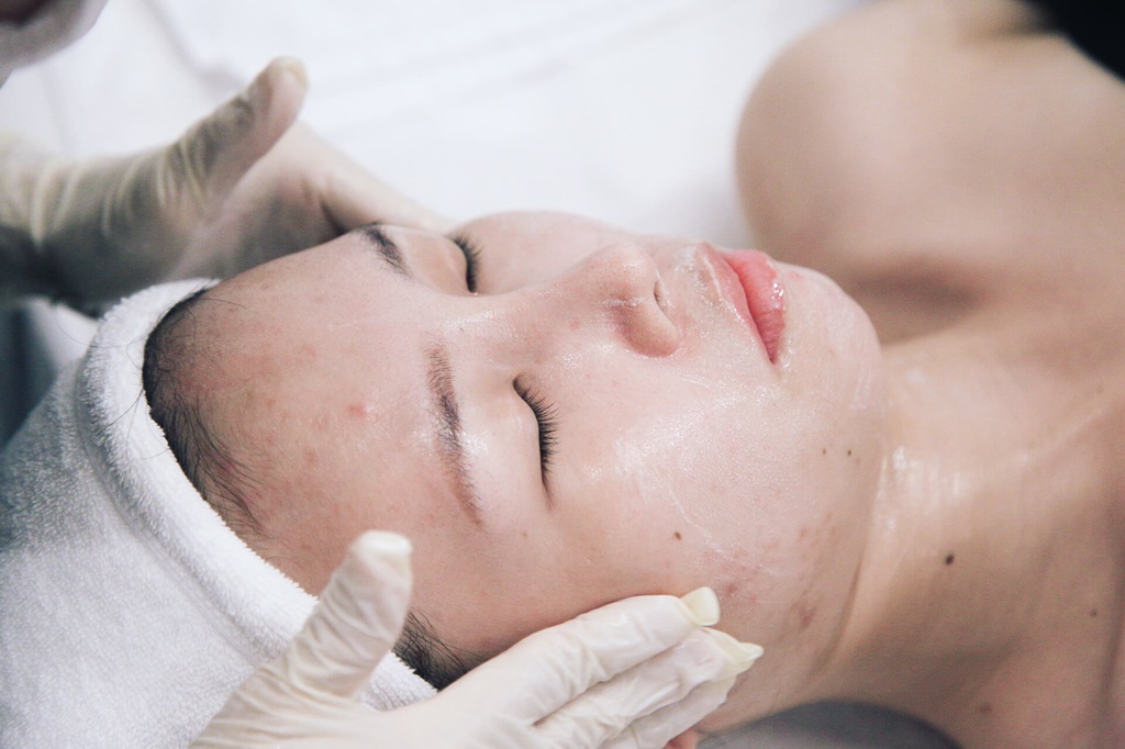 Đi nặn mụn ở Spa cần lưu ý những gì?