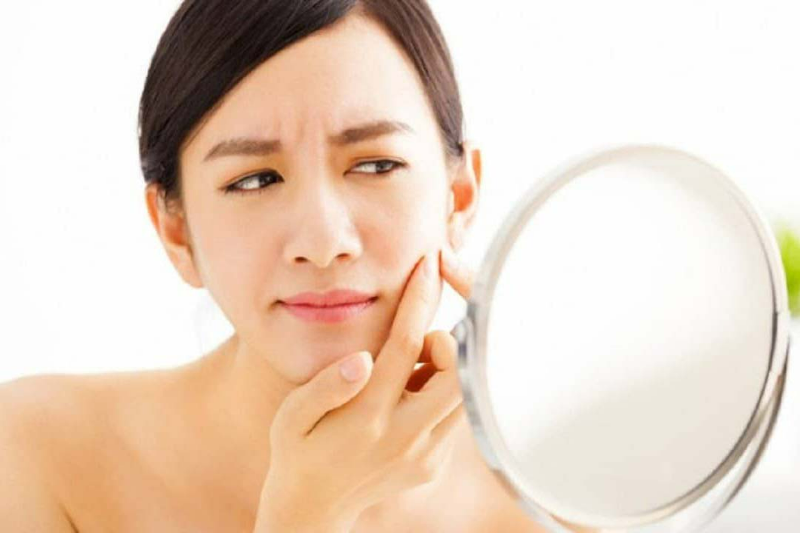 Sau khi kết thúc nặn mụn