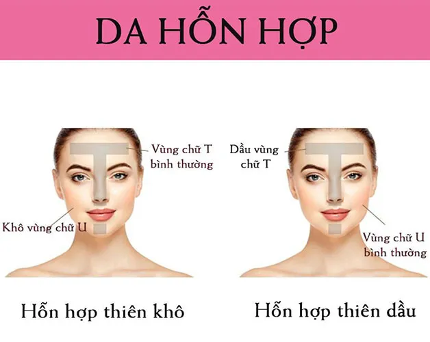 Phân biệt cơ bản của da hỗn hợp