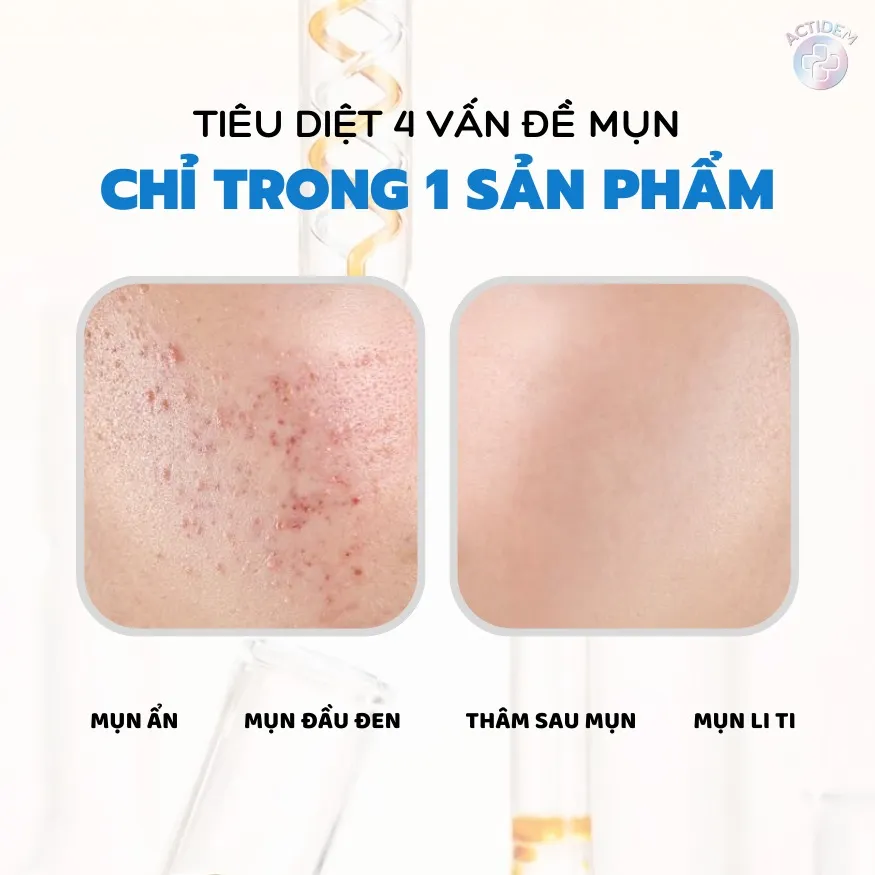 Công dụng chính của gel