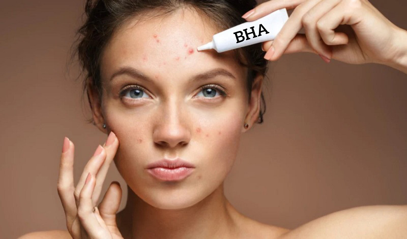 BHA ( Salicylic Acid ) - hoạt chất giảm mụn ẩn - cứu tinh của phái đẹp