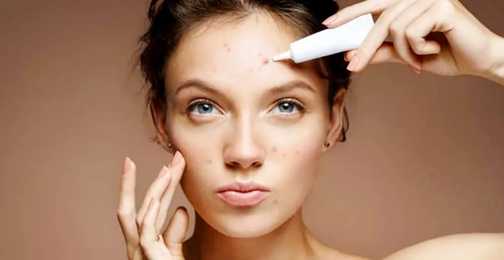 Tiêu chí giúp bạn lựa chọn kem trị mụn hiệu quả