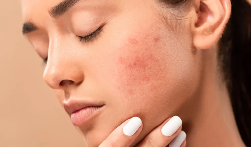Tránh sử dụng sản phẩm gây kích ứng