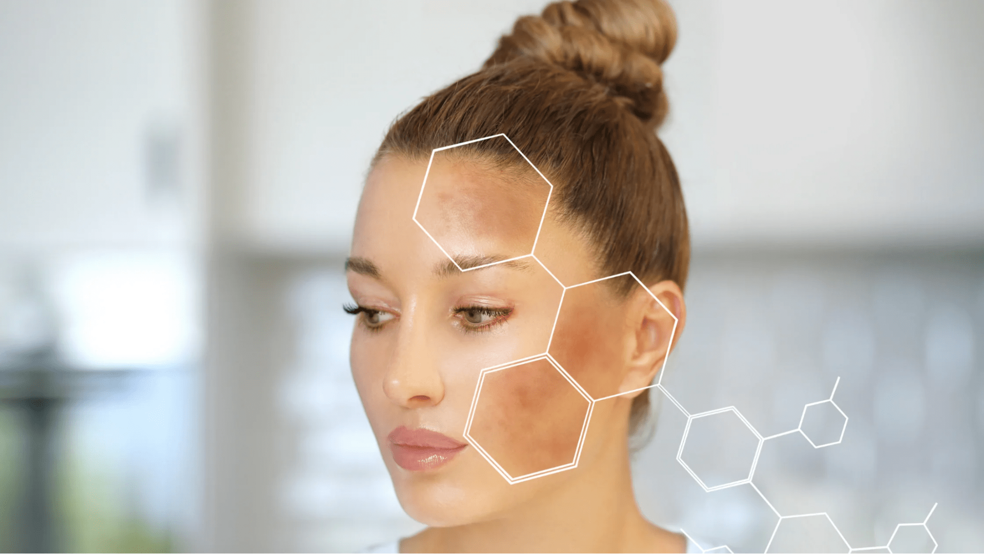 Sắc tố melanin gây nên tình trạng sẫm màu ở da