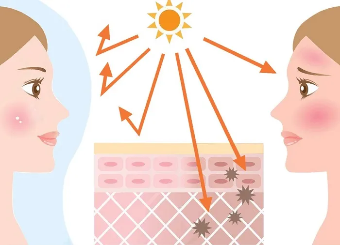 Tia UV- kẻ thù của mọi làn da