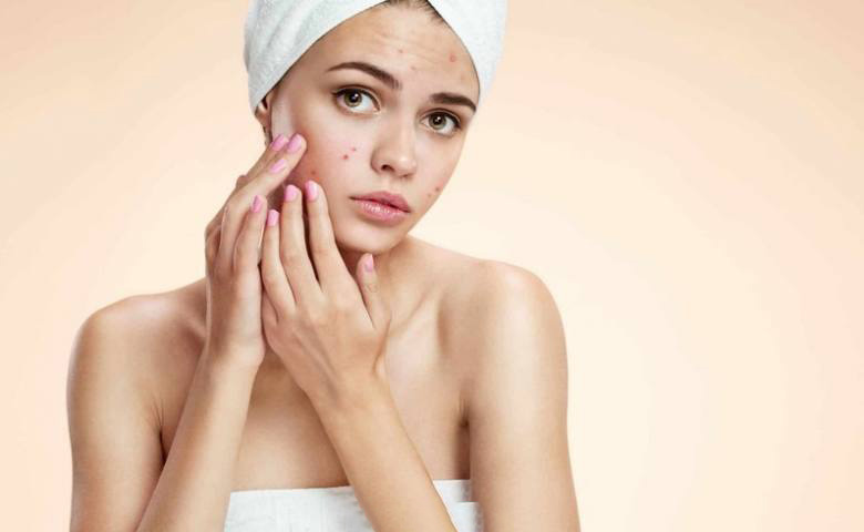 Sờ tay lên má quá nhiều sẽ mang vi khuẩn tiếp xúc với da mặt