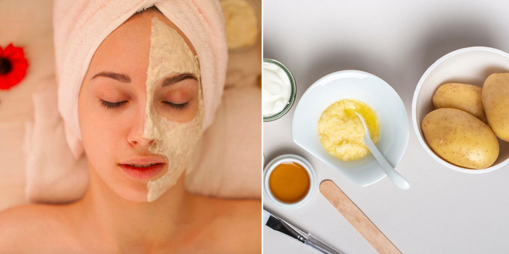 Trị mụn ẩn quanh miệng bằng thiên nhiên