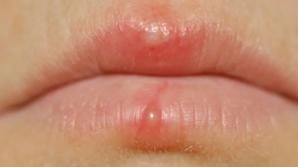 Do sự tăng sản xuất dầu quá mức