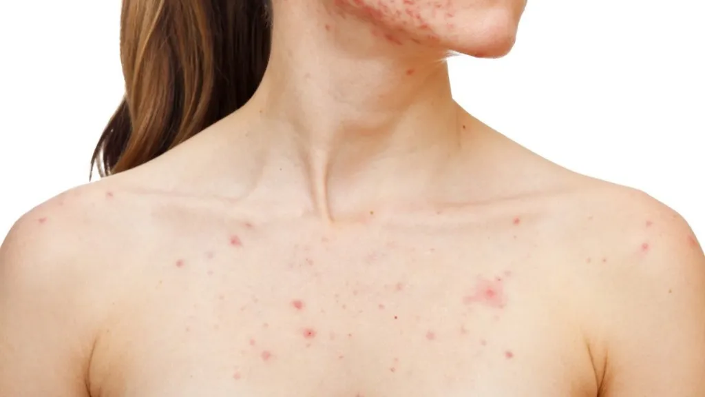 Sự tăng sản xuất dầu da