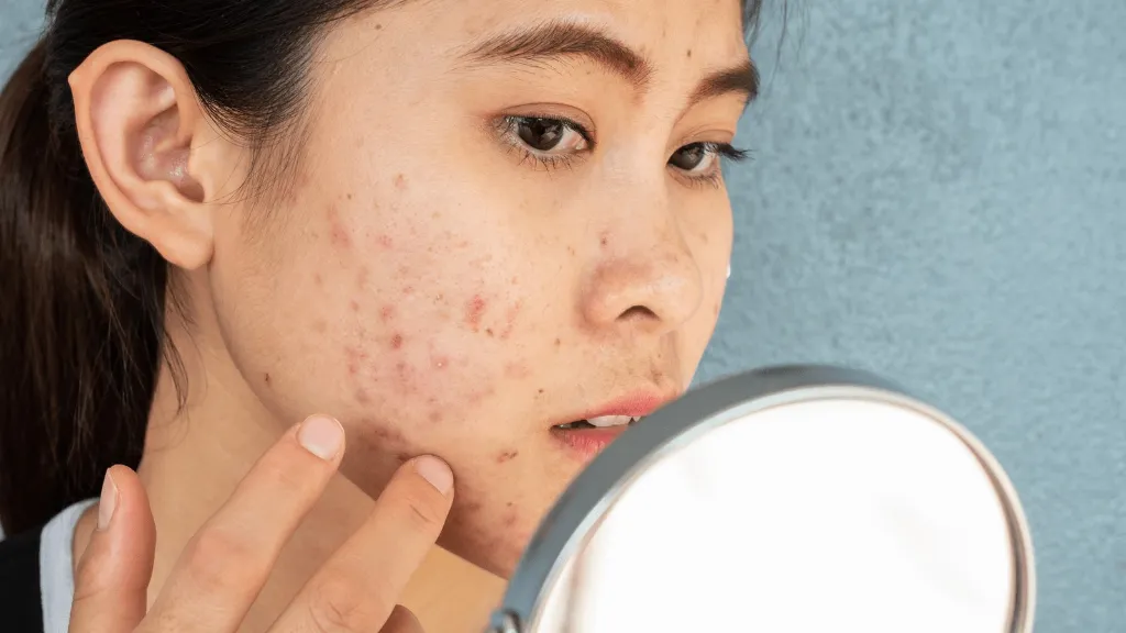 Sự biến động liên tục của Hormone