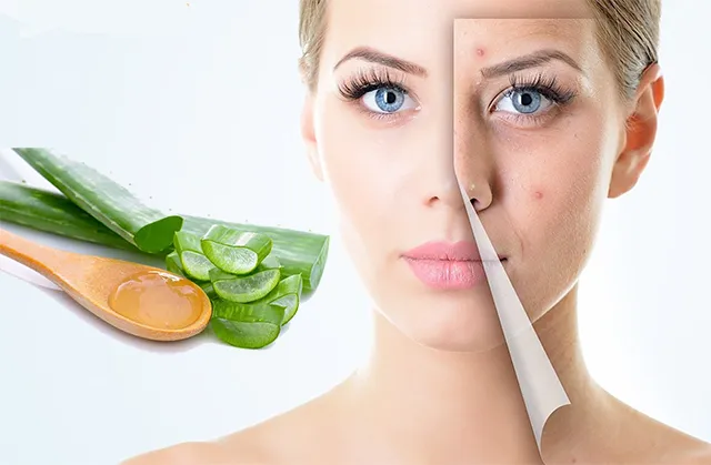 Nha đam với công dụng làm dịu da và giảm thâm hữu hiệu