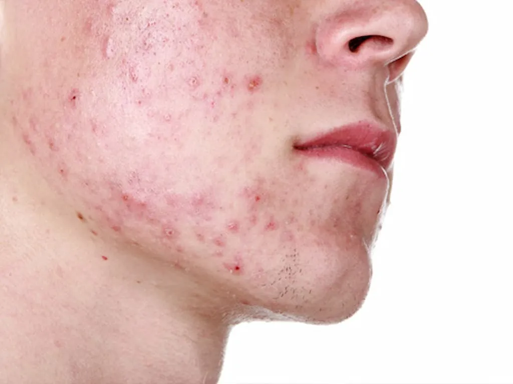 Tác hại của việc rửa mặt quá nhiều hoặc quá ít
