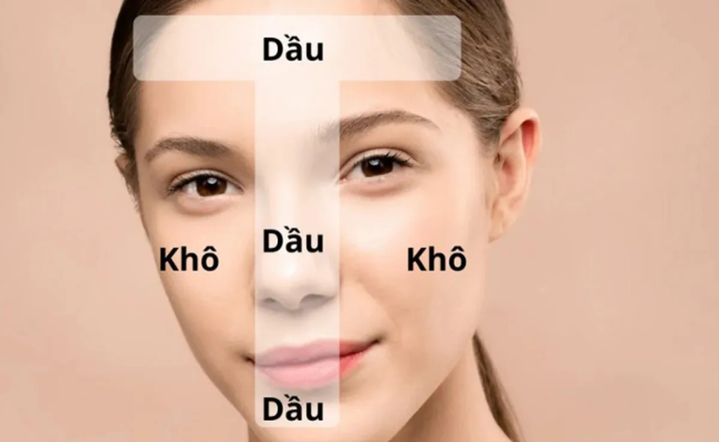 Da hỗn hợp là gì?