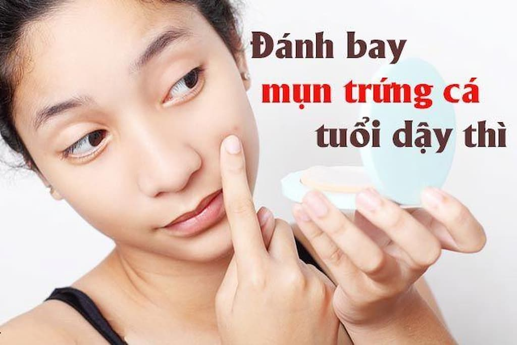 Bôi kem đặc trị