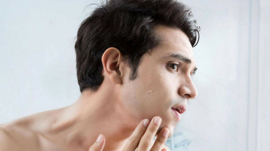 Đặc điểm làn da nam