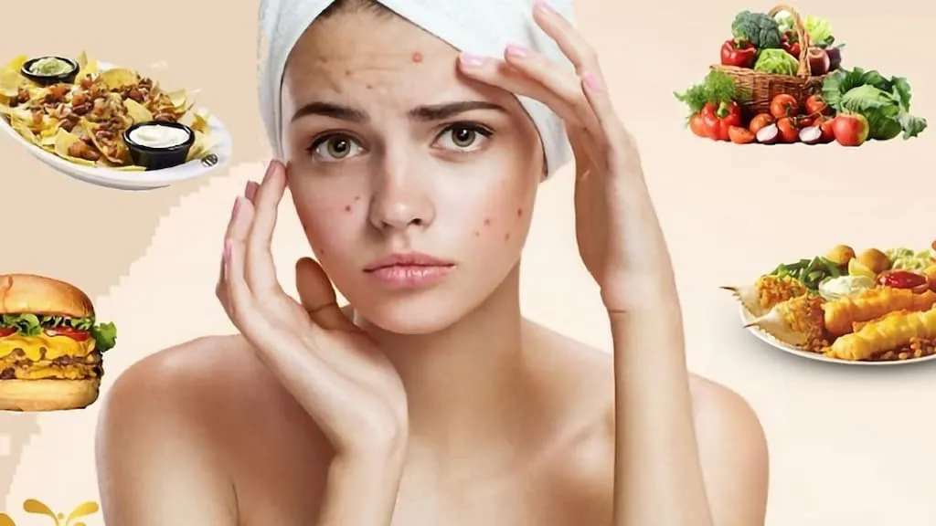 Ăn uống như thế nào khi chăm sóc da mụn?