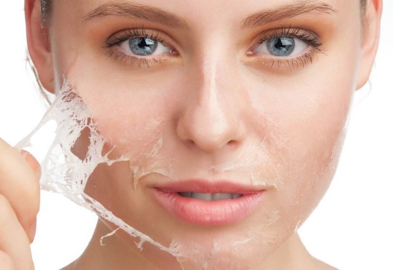 Áp dụng các cách trị mụn ẩn bằng công nghệ hiện đại