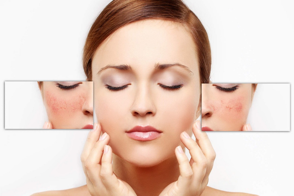 Sản phẩm phù hợp sẽ tránh kích ứng da