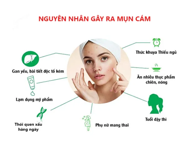 Các nguyên nhân gây mụn cám