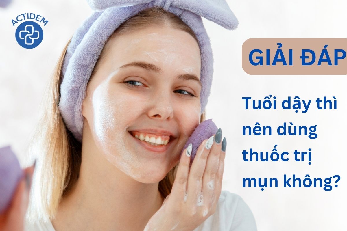 Giải đáp tuổi dậy thì có nên dùng thuốc giảm mụn không?