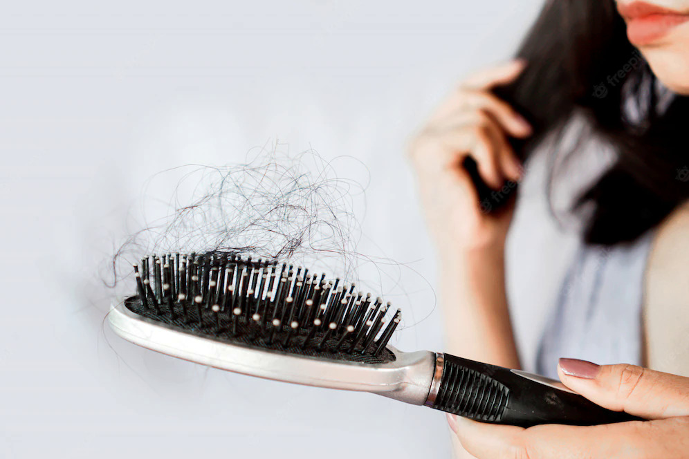 Rụng tóc có thể do cơ thể thiếu dưỡng chất 