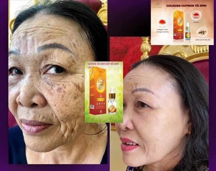 Collagen Saffon tái sinh