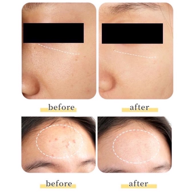 Tinh chất huyết tương EVENSWISS REGENERATING PLASMA