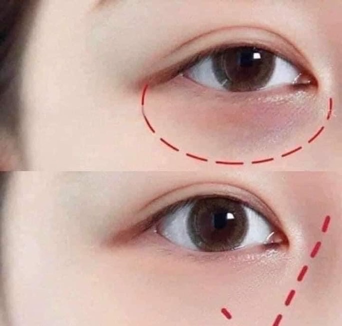 Kem Mắt Dưỡng Trắng và Loại bỏ quầng thâm AHC Ageless Real Eye Cream For Face 30ml